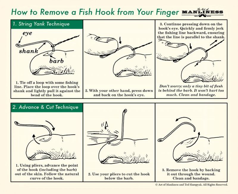 Can anyone share a photo of a fishing hook in their hand or finger