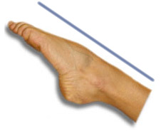 plantarflex.jpg