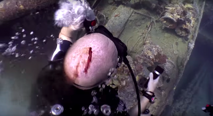 wreck-dive-injury-max-w700.png