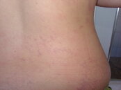 skin bends2004 002 (2).jpg