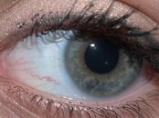 eye.jpg
