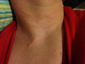 neck2.jpg