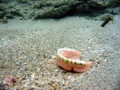 dentures.jpg