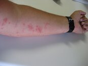 Mini Lobster Season - dive rash 004.jpg