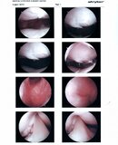 Knee Surgery pictures_Page_1.jpg