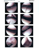 Knee Surgery pictures_Page_2.jpg