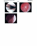 Knee Surgery pictures_Page_3.jpg