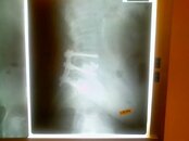 x-ray_1.jpg