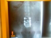 x-ray_2.jpg