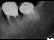 dental 19 and 18.jpg