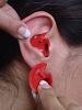 117197d1330432928t-ear-infections-constant-problem-3977_3.jpg
