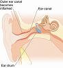 117196d1330432151t-ear-infections-constant-problem-original.jpg